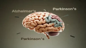 Cérebro Humano com Marcadores de Alzheimer e Parkinson