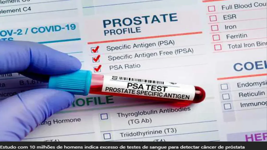 Excesso de Testes de PSA para Câncer de Próstata10 milhões de homens fazem texte PSA