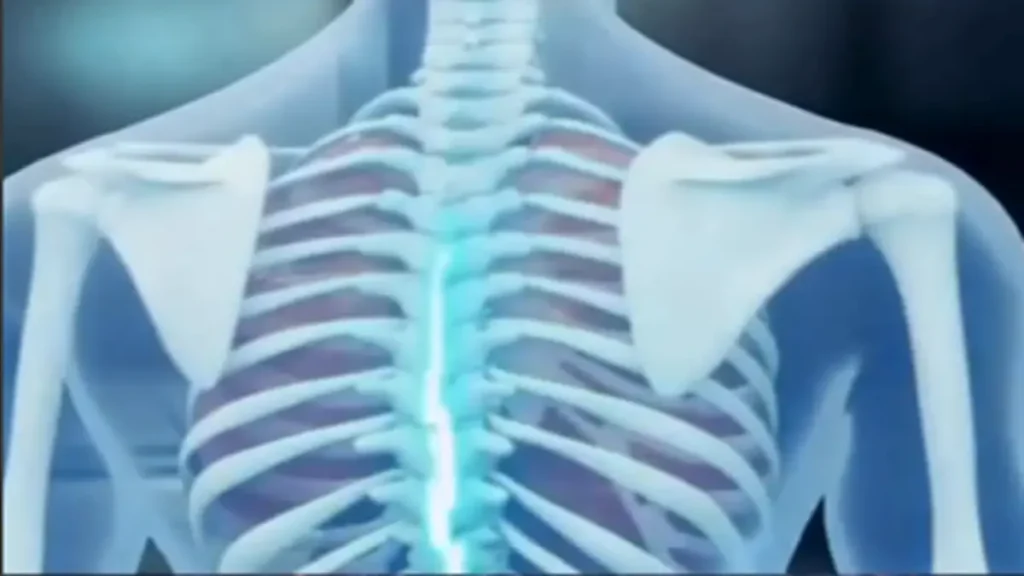 Polilaminina: Descoberta de Tatiana Sampaio (UFRJ)